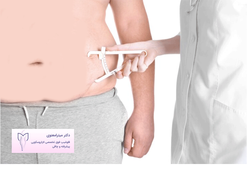 چاقی و دیابت
