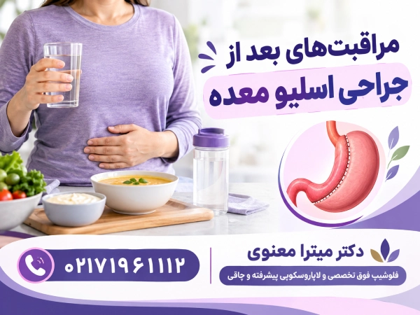 مراقبتهای بعد از جراحی اسلیو معده
