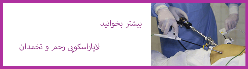 لاپاراسکوپی کیست